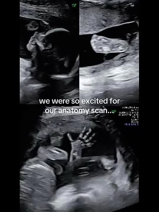 Беременность превратилась в комедийное шоу: малыш копирует любимого питомца