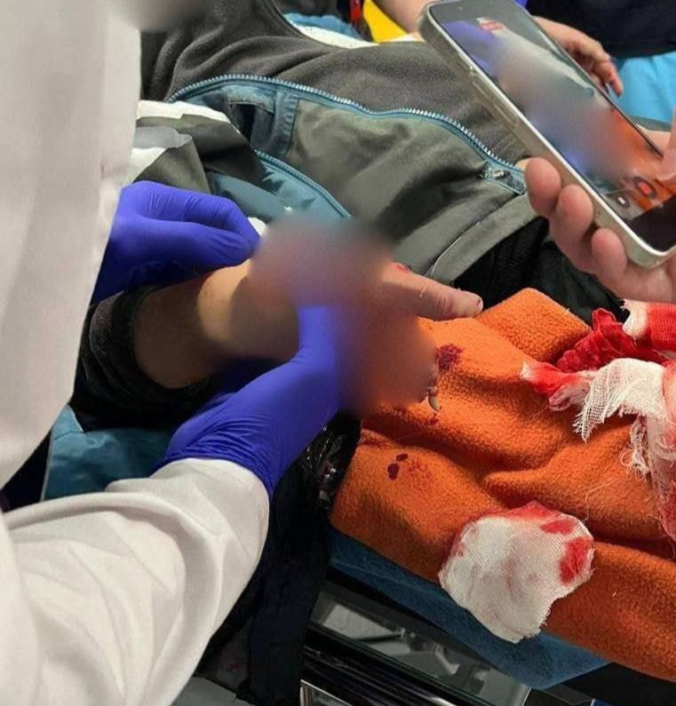 Взрыв под Москвой: мальчику оторвало пальцы, когда он поднял деньги на детской площадке Взрыв под Москвой: мальчику оторвало пальцы, когда он поднял деньги на детской площадке