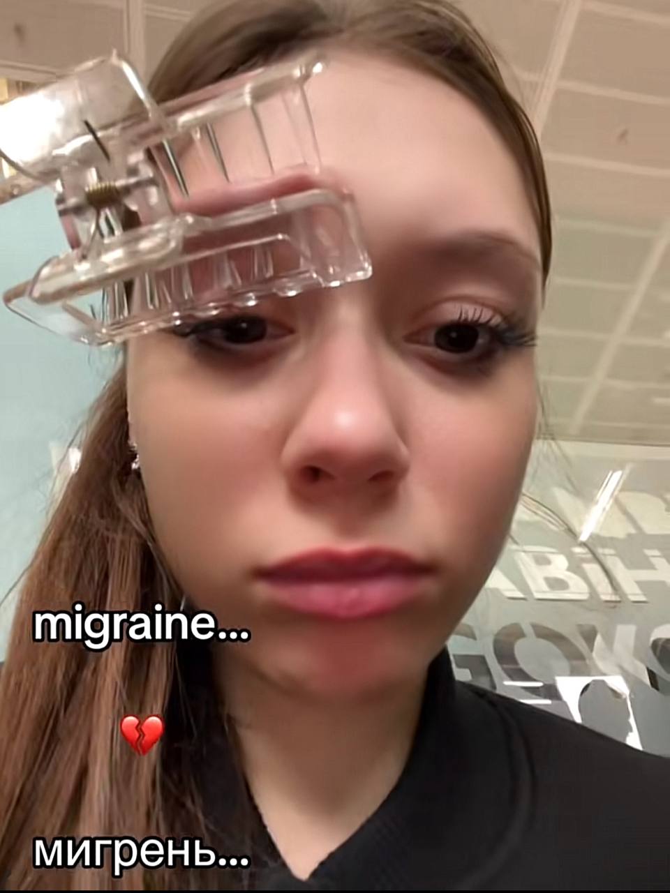 Заколка спасет от мигрени? Заколка спасет от мигрени?