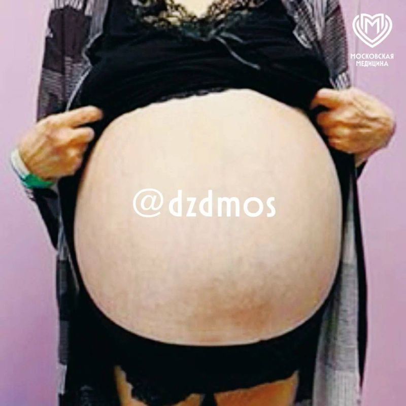 �� ������� �������� � �������� ����� �������� ��������� ���������� �������-����������