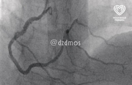 ������� ���� ������� � ������� �������