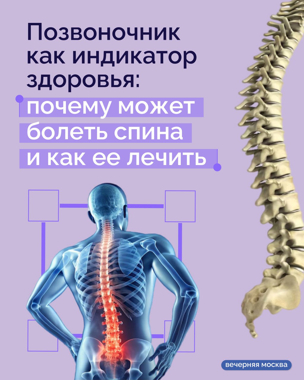 Многие обращаются к врачу только тогда, когда боль в спине становится невыносимой