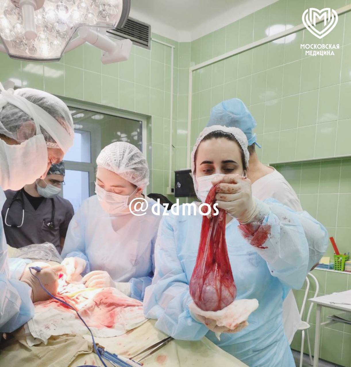 Столичные хирурги удалили у 15-летней пациентки кисту размером с живот