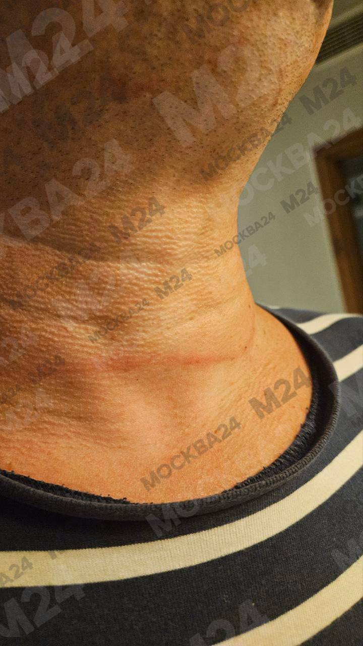 Британские туристы избили многодетную семью из Москвы в египетском 5-звёздочном отеле Британские туристы избили многодетную семью из Москвы в египетском 5-звёздочном отеле