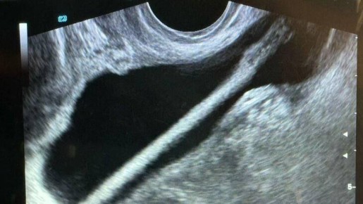 ����� ������� �� �������� ������ ������� ������������� ��������