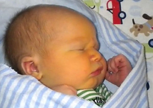 Как справиться с желтухой у новорожденных: мифы и реальность