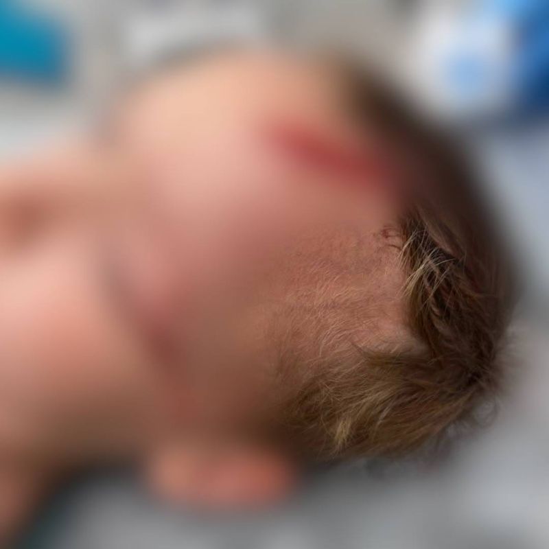 На семилетнего внука писательницы Дарьи Донцовой напала собака
