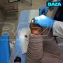 Россиянке вскрыли пятку и колено после отдыха на пляже во Вьетнаме