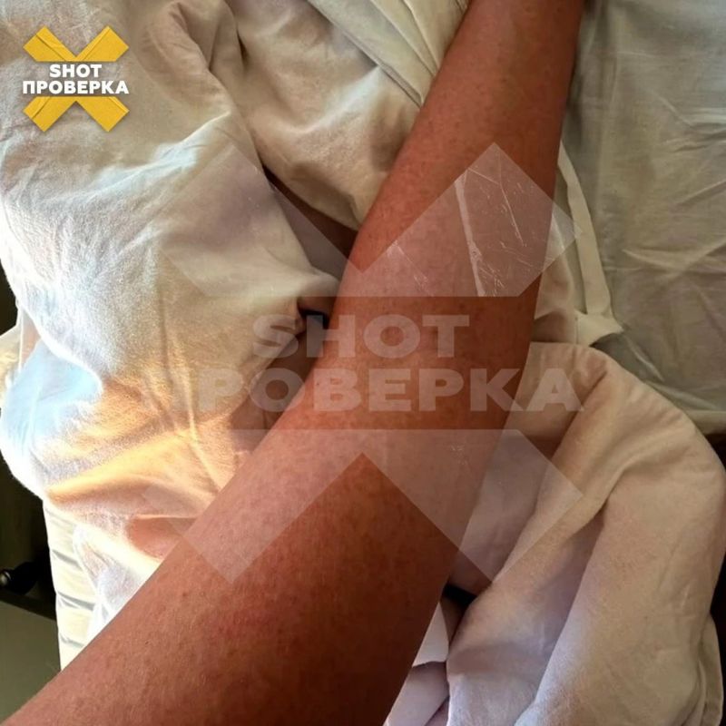 Редкую лихорадку Зика привезла с Бали россиянка — после возвращения в Москву девушку госпитализировали с температурой и сыпью по всему телу Редкую лихорадку Зика привезла с Бали россиянка — после возвращения в Москву девушку госпитализировали с температурой и сыпью по всему телу